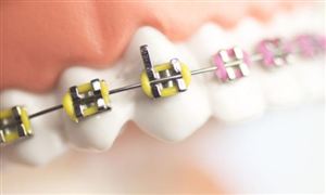 2024城市污水处理行业深度分析及投资战略研究(图7)